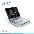 AG-BU007 electronic convex array hospital scanner pregnancy scanner ultrasound supplier